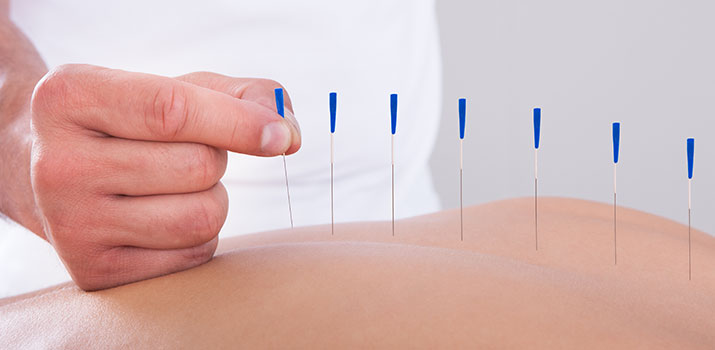Akupunktur - Schmerzen - Behandlung - Therapie - TCM - Dr. med. Rainer Leipert - Bad Wimpfen